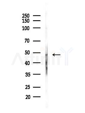 Argininosuccinate Lyase Antibody - Western blot analysis of lysates from LoVo cells(heat-shock,45min treatment), using Argininosuccinate Lyase Antibody at 1/1000 dilution.