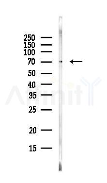 HPSE2 Antibody - Western blot analysis of lysates from EC304 cells(LPS, 4h treatment), using HPSE2 Antibody at 1/1000 dilution.