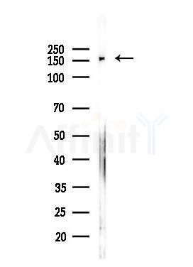 ARAP1 Antibody - Western blot analysis of lysates from Hela cells(heat-shock,45min treatment), using ARAP1 Antibody at 1/1000 dilution.