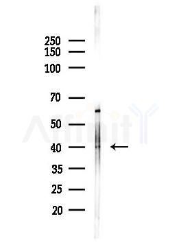 Spermine synthase Antibody - Western blot analysis of lysates from Hela cells(heat-shock,45min treatment), using Spermine synthase Antibody at 1/1000 dilution.
