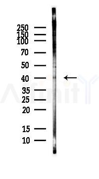 Unrip Antibody - Western blot analysis of lysates from HepG2 cells(LPS, 4h treatment), using Unrip Antibody at 1/1000 dilution.