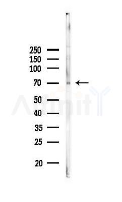 YTHDF3 Antibody - Western blot analysis of lysates from PC12 cells, using YTHDF3 Antibody at 1/1000 dilution.