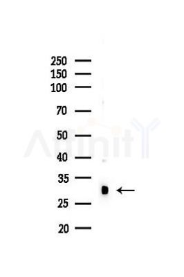 NAA60 Antibody - Western blot analysis of lysates from Mouse liver, using NAA60 Antibody at 1/1000 dilution.