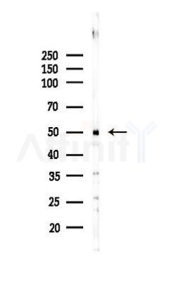 PAPD4 Antibody - Western blot analysis of lysates from Mouse liver, using PAPD4 Antibody at 1/1000 dilution.