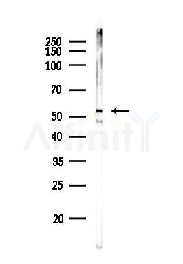 PAPD4 Antibody - Western blot analysis of lysates from MCF7 cells(heat-shock,45min treatment), using PAPD4 Antibody at 1/1000 dilution.