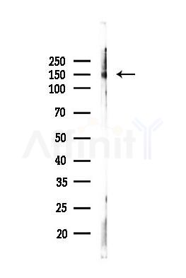 INO80 Antibody - Western blot analysis of lysates from Mouse liver, using INO80 Antibody at 1/1000 dilution.