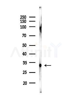 EFHD2 Antibody - Western blot analysis of lysates from EC304 cells(heat-shock,45min treatment), using EFHD2 Antibody at 1/1000 dilution.