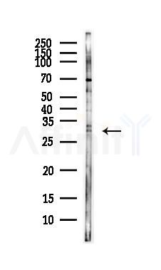 Protease Inhibitor 15 Antibody - Western blot analysis of lysates from HepG2 cells(LPS, 4h treatment), using Protease Inhibitor 15 Antibody at 1/1000 dilution.