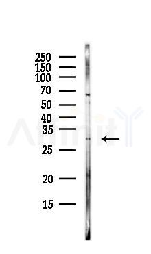 Protease Inhibitor 15 Antibody - Western blot analysis of lysates from EC304 cells(LPS, 4h treatment), using Protease Inhibitor 15 Antibody at 1/1000 dilution.