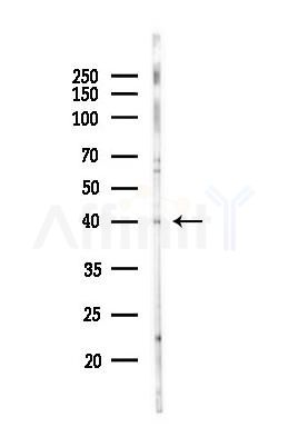 Melatonin Receptor 1A Antibody - Western blot analysis of lysates from EC304 cells(heat-shock,45min treatment), using Melatonin Receptor 1A Antibody at 1/1000 dilution.