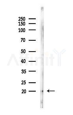 Ascl2 Antibody - Western blot analysis of lysates from EC304 cells(heat-shock,45min treatment), using Ascl2 Antibody at 1/1000 dilution.