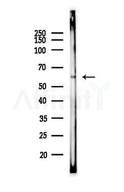 ANKHD1 Antibody - Western blot analysis of lysates from MCF7 cells(heat-shock,45min treatment), using ANKHD1 Antibody at 1/1000 dilution.