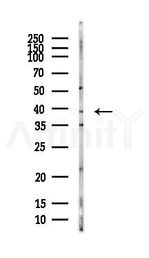 PHYH Antibody - Western blot analysis of lysates from HepG2 cells(LPS, 4h treatment), using PHYH Antibody at 1/1000 dilution.