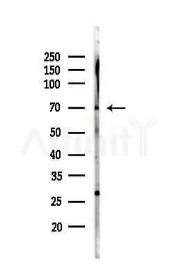 MSL1 Antibody - Western blot analysis of lysates from Mouse liver, using MSL1 Antibody at 1/1000 dilution.