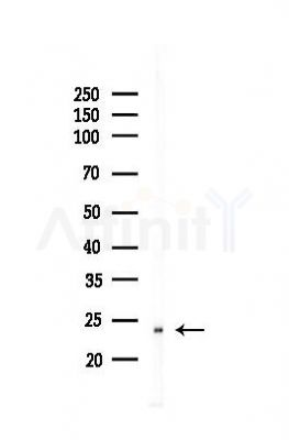 TMEM199 Antibody - Western blot analysis of lysates from Mouse liver, using TMEM199 Antibody at 1/1000 dilution.