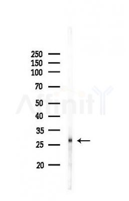 KHDC1 Antibody - Western blot analysis of lysates from PC12 cells, using KHDC1 Antibody at 1/1000 dilution.