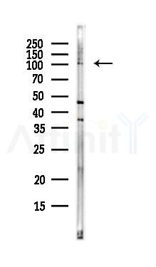 CCDC39 Antibody - Western blot analysis of lysates from EC304 cells(LPS, 4h treatment), using CCDC39 Antibody at 1/1000 dilution.