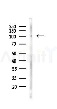 CCDC39 Antibody - Western blot analysis of lysates from Mouse lung, using CCDC39 Antibody at 1/1000 dilution.