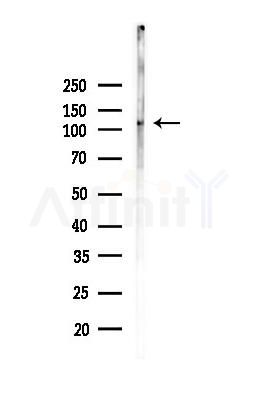 GUCY2C Antibody - Western blot analysis of lysates from Mouse liver, using GUCY2C Antibody at 1/1000 dilution.