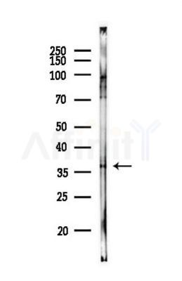 Cathepsin V Antibody - Western blot analysis of lysates from MCF7 cells(heat-shock,45min treatment), using Cathepsin V Antibody at 1/1000 dilution.