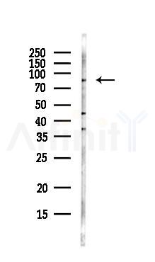 PRDM4/PFM1 Antibody - Western blot analysis of lysates from EC304 cells(LPS, 4h treatment), using PRDM4/PFM1 Antibody at 1/1000 dilution.