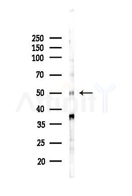 CHES1 Antibody - Western blot analysis of lysates from Mouse liver, using CHES1 Antibody at 1/1000 dilution.