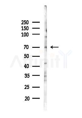 CDKN2AIP Antibody - Western blot analysis of lysates from Mouse liver, using CDKN2AIP Antibody at 1/1000 dilution.