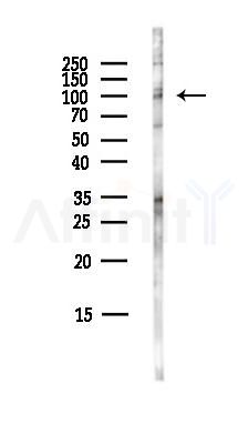 PACE4 Antibody - Western blot analysis of lysates from COLO205 cells(heat-shock,45min treatment), using PACE4 Antibody at 1/1000 dilution.