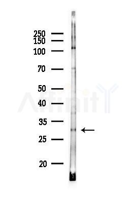Synaptogyrin 2 Antibody - Western blot analysis of lysates from MCF7 cells(heat-shock,45min treatment), using Synaptogyrin 2 Antibody at 1/1000 dilution.