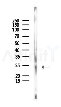 TMEM126A Antibody - Western blot analysis of lysates from Mouse kidney, using TMEM126A Antibody at 1/1000 dilution.
