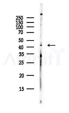 OTULIN Antibody - Western blot analysis of lysates from EC304 cells(heat-shock,45min treatment), using OTULIN Antibody at 1/1000 dilution.
