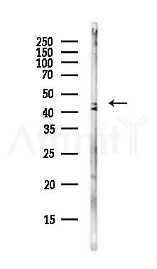 OTULIN Antibody - Western blot analysis of lysates from B16F10-LUC cells(starvation,24h treatment), using OTULIN Antibody at 1/1000 dilution.