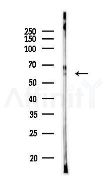 AMPS Antibody - Western blot analysis of lysates from PC12 cells, using Adenylosuccinate Lyase Antibody at 1/1000 dilution.
