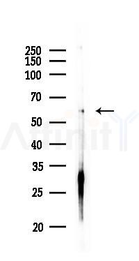 ABLIM3 Antibody - Western blot analysis of lysates from PC12 cells, using ABLIM3 Antibody at 1/1000 dilution.
