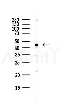 GOT2 Antibody - Western blot analysis of lysates from EC304 cells(heat-shock,45min treatment), using GOT2 Antibody at 1/1000 dilution.