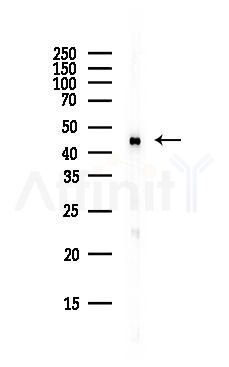 GOT2 Antibody - Western blot analysis of lysates from B16F10-LUC cells(starvation,24h treatment), using GOT2 Antibody at 1/1000 dilution.