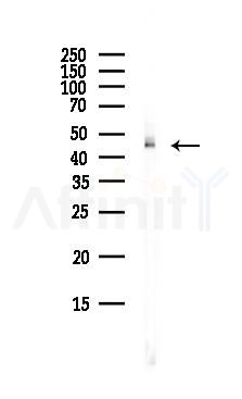 BRF2 Antibody - Western blot analysis of lysates from EC304 cells(heat-shock,45min treatment), using BRF2 Antibody at 1/1000 dilution.