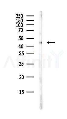 BRF2 Antibody - Western blot analysis of lysates from B16F10-LUC cells(starvation,24h treatment), using BRF2 Antibody at 1/1000 dilution.