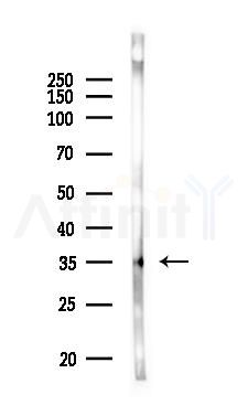 CIAPIN1 Antibody - Western blot analysis of lysates from PC12 cells, using CIAPIN1 Antibody at 1/1000 dilution.