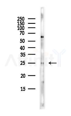 EXOSC5 Antibody - Western blot analysis of lysates from EC304 cells(heat-shock,45min treatment), using EXOSC5 Antibody at 1/1000 dilution.