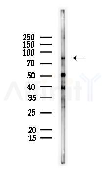 KRIT1 Antibody - Western blot analysis of lysates from Mouse kidney, using KRIT1 Antibody at 1/1000 dilution.