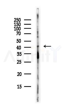 GPCR GPR65 Antibody - Western blot analysis of lysates from EC304 cells(heat-shock,45min treatment), using GPCR GPR65 Antibody at 1/1000 dilution.