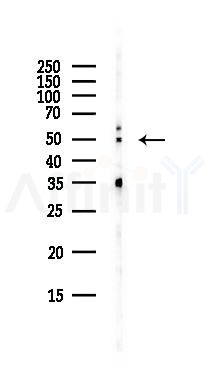 PRUNE Antibody - Western blot analysis of lysates from EC304 cells(heat-shock,45min treatment), using PRUNE Antibody at 1/1000 dilution.