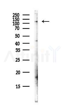 ARS2 Antibody - Western blot analysis of lysates from B16F10-LUC cells(starvation,24h treatment), using ARS2 Antibody at 1/1000 dilution.