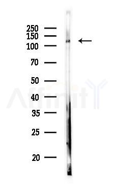 ARS2 Antibody - Western blot analysis of lysates from PC12 cells, using ARS2 Antibody at 1/1000 dilution.
