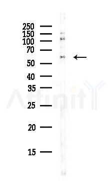 UGT1A1 Antibody - Western blot analysis of lysates from B16F10-LUC cells(starvation,24h treatment), using UGT1A1 Antibody at 1/1000 dilution.