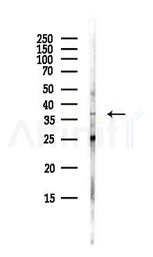 PDLIM2 Antibody - Western blot analysis of lysates from EC304 cells(heat-shock,45min treatment), using PDLIM2 Antibody at 1/1000 dilution.