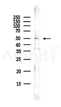 IRX3 Antibody - Western blot analysis of lysates from EC304 cells(heat-shock,45min treatment), using Iroquois homeobox protein 3 Antibody at 1/1000 dilution.
