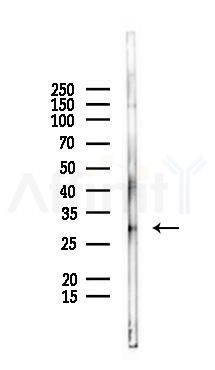 IMPA1 Antibody - Western blot analysis of lysates from Mouse kidney, using IMPA1 Antibody at 1/1000 dilution.