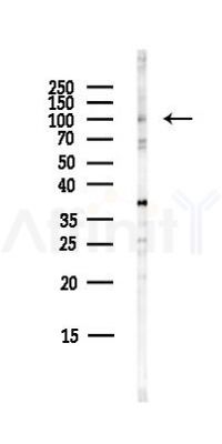 CRNKL1 Antibody - Western blot analysis of lysates from COLO205 cells(heat-shock,45min treatment), using CRNKL1 Antibody at 1/1000 dilution.